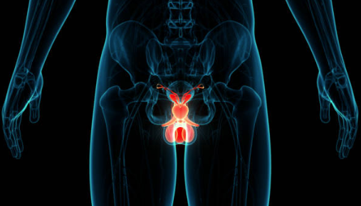 What is the main cause of prostate enlargement?