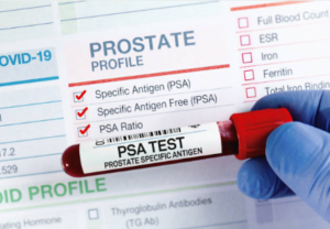 Enlarged Prostate - PSA test